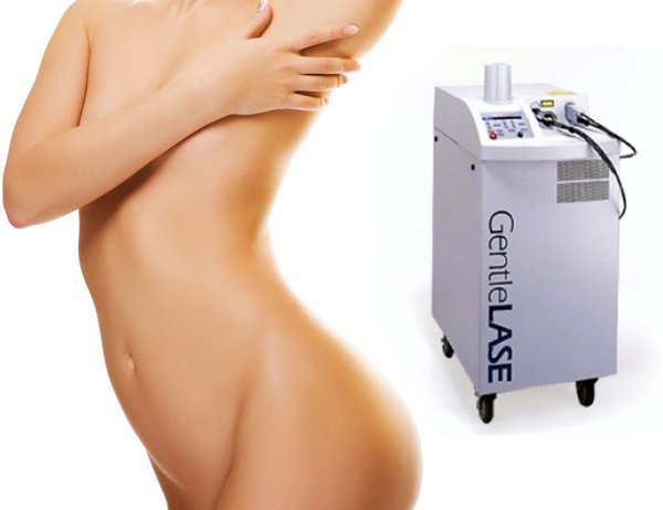 Laser Hair removal
